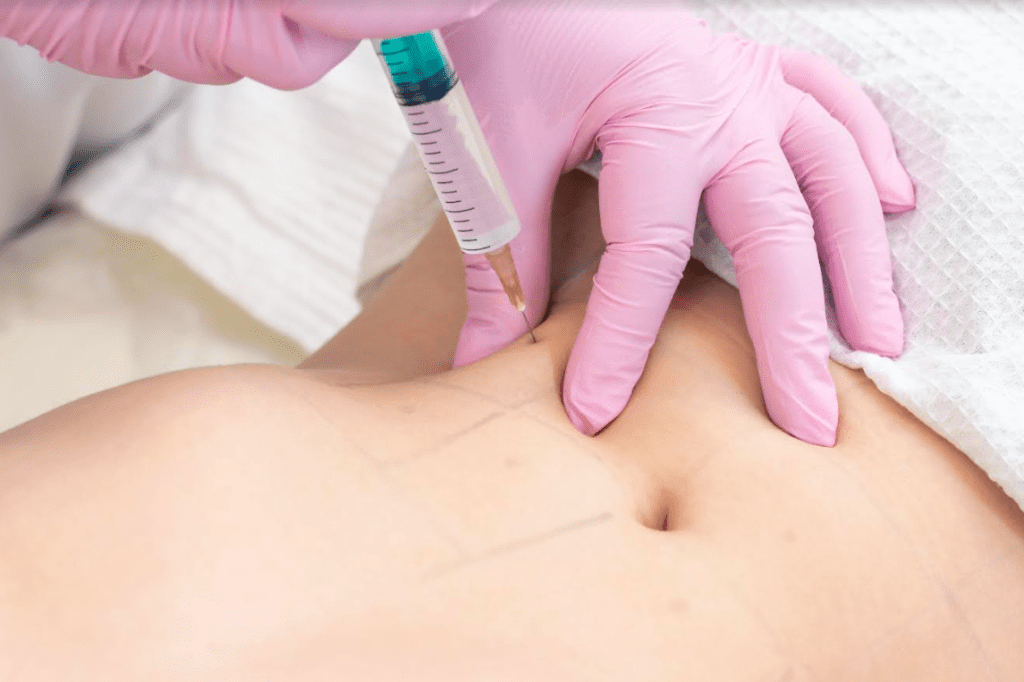  hidrolipoclasia não aspirativa é um procedimento estético que viabiliza a implosão das gorduras localizadas